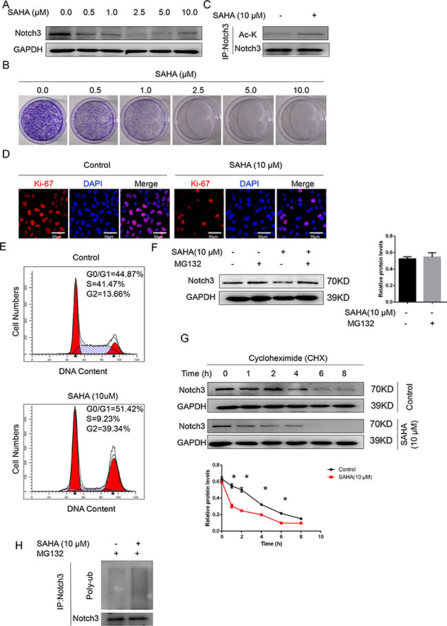 The HDAC inhibitor SAHA decreases Notch3 stability in urothelial cancer cells.