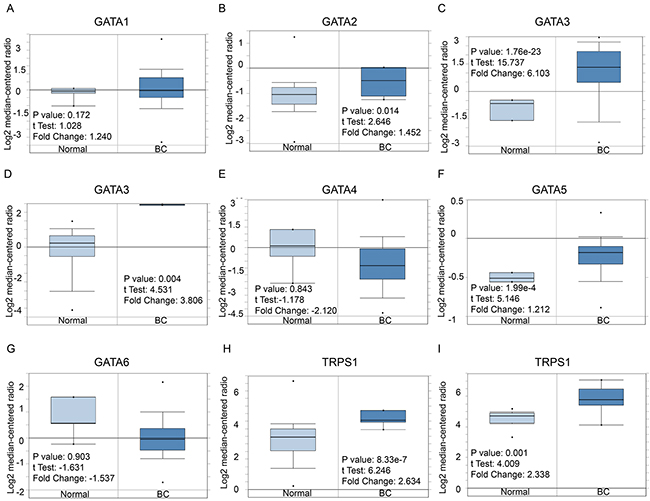 GATA family analysis in Breast cancer (ONCOMINE database).