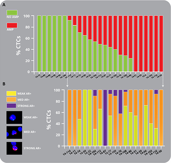 Heterogeneity of amplification in mCRPC patient CTCs.