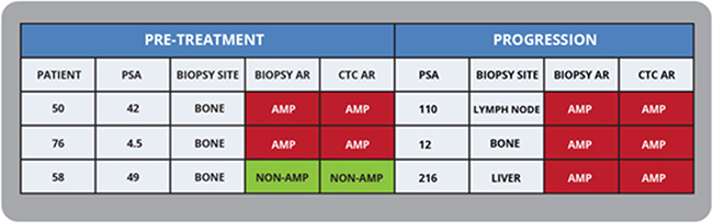 Documenting AR Amplification status with sequential CTC and biopsies in mCRPC patients.