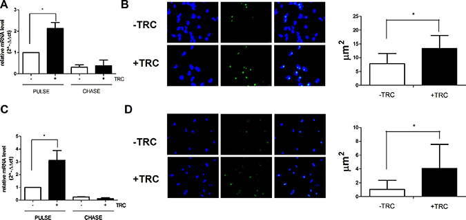 JHDM1B knock-down causes a surge in 45S pre-RNA synthesis and processing.