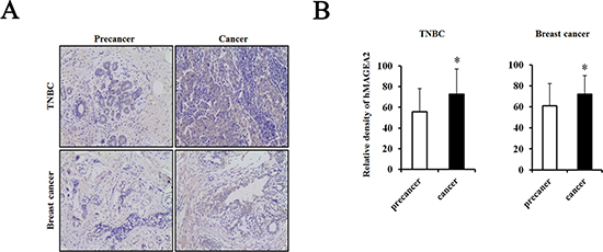 hMAGEA2 is overexpressed in human triple-negative breast cancer (TNBC) tissues and breast cancer tissues with TNBC.