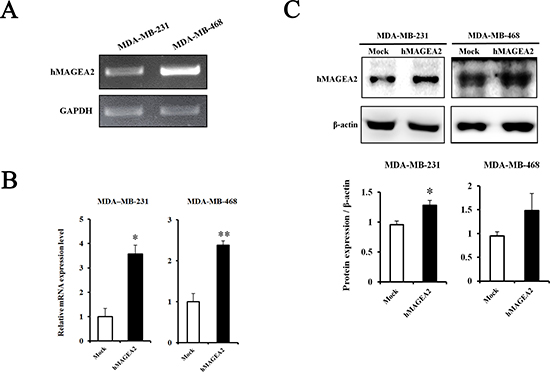 Establishment of stable overexpression of hMAGEA2 in TNBC cell lines.