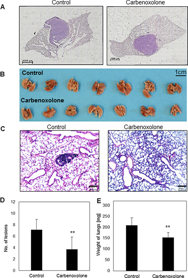 Effect of Carbenoxolone in orthotopic primary growth and tail vein injection.