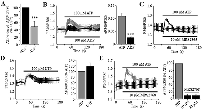 No major role of the P2Y1 and P2Y2 receptors in ATP-induced increase in the [Ca2+]i in Huh-7 cells.
