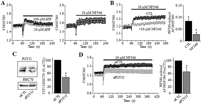 A role of the P2Y11 receptor in ATP-induced increase in the [Ca2+]i in HepG2 cells.