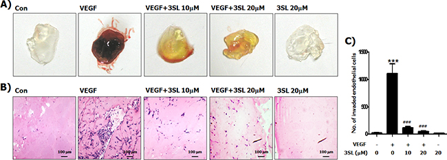 Inhibitory effect of sialyllactose on VEGF-induced in vivo neovascularization.