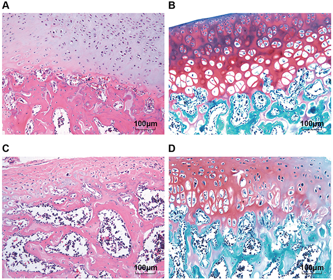 Comparisons of structure changes of the normal articular cartilage tissues and OA articular cartilage tissues according to the HE staining and safranin O/fast green FCF staining (200 &#x00D7;).