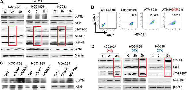 Bcl-2, TGF-&#x03B2;R1 and ATM signaling assessed by Western blot and FACS in selected TNBC cell lines.