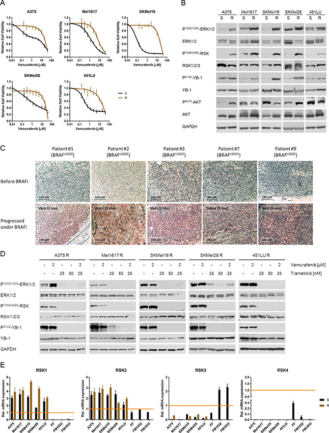 Vemurafenib resistant melanoma cells exhibit enhanced RSK activity due to hyperactivated MAPK signalling.
