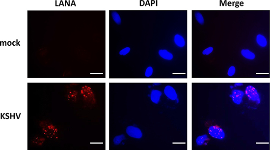 Establishment of latent KSHV infection within SiHa cells.