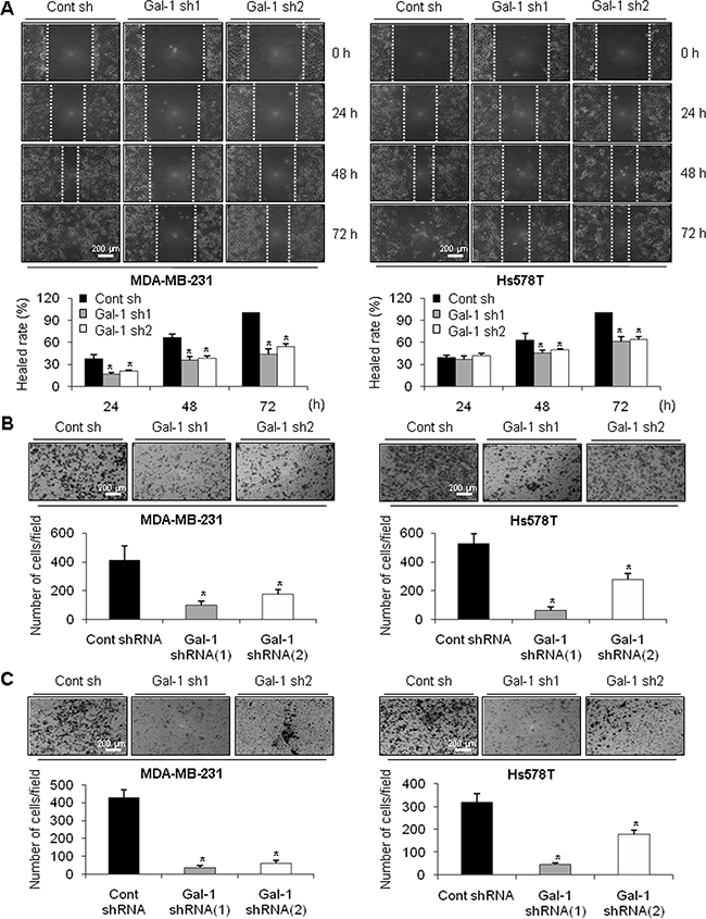 Effect of galectin-1 silencing on migration and invasion of human breast cancer cells.
