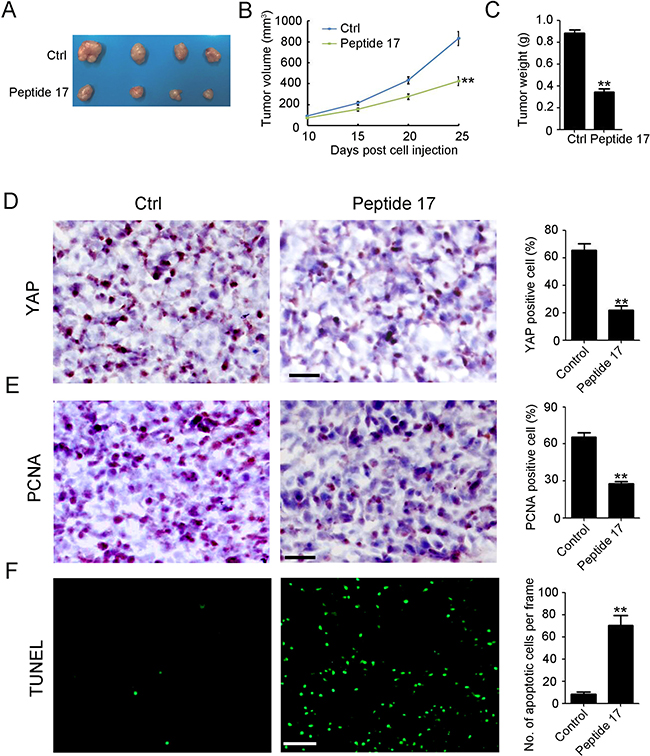 Knockdown of YAP inhibits neuroblastoma tumor growth in vivo.