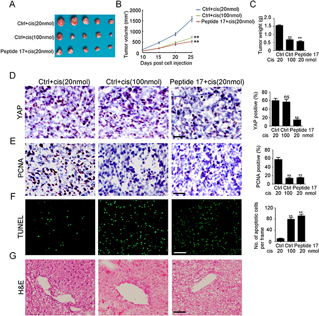 Knockdown of YAP inhibits cisplatin resistant neuroblastoma tumor growth in vivo.