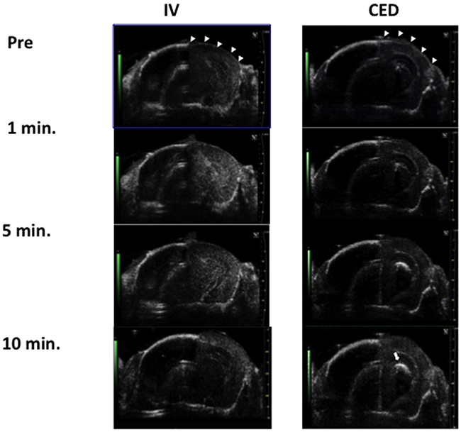 Comparison of microbubble distribution through IV administration (left) and through CED catheter infusion (right) under the observations of small animal diagnostic ultrasound.