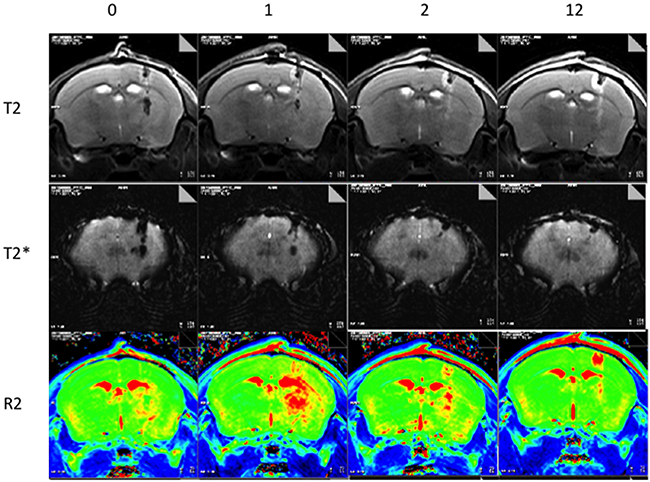 Representative MRI showing longitudinal observations up to 12 hours after Dox-MB infusion.