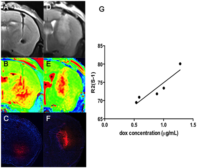 Co-localization of T2 images (A and D) and R2 maps (B and E) with the Dox distribution observed in fluorescence microscopy (C and F) both in normal (A-C) and tumor-implant brain (D-F) (Red: Dox; blue: DAPI for identifying cell nucleus; bar = 1 mm).