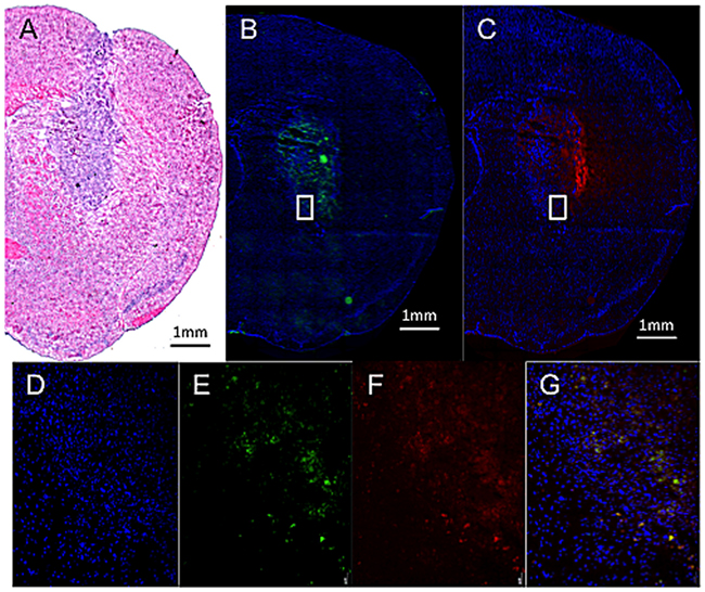 Fluorescent microscopic observation of Dox-MB in tumor-implant brain after CED infusion.