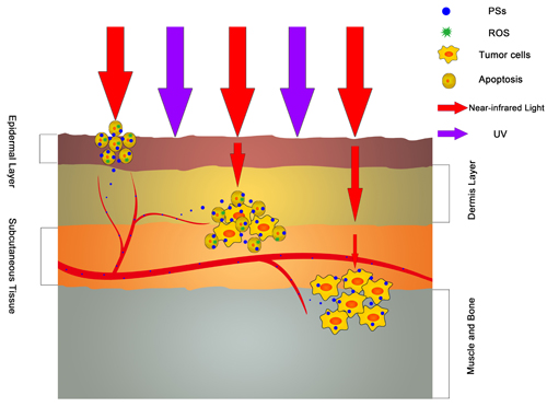 The antitumor effect of various wavelength light sources.