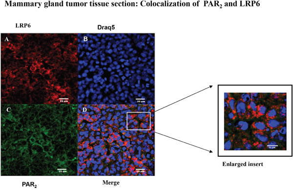 Colocalization between LRP6 and PAR2 in breast mouse cancer tumor biopsies: confocal analysis.