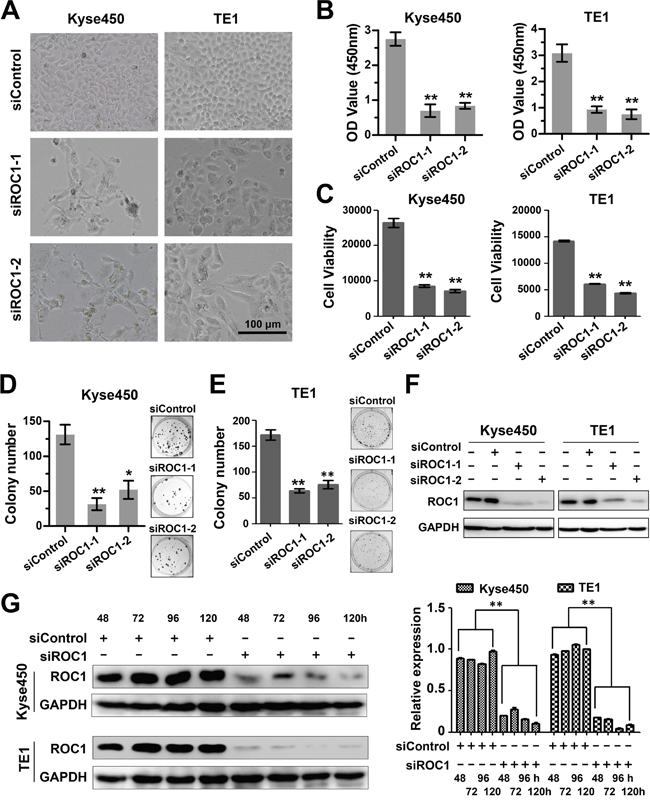 Knockdown of ROC1 inhibited proliferation of human esophageal cancer cells.