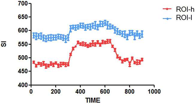 Time-SI curves for the ROIs-h and ROIs-l in one representative brain tumor.