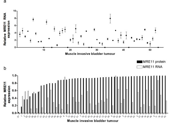 Bladder tumour MRE11 RNA and protein expression levels.