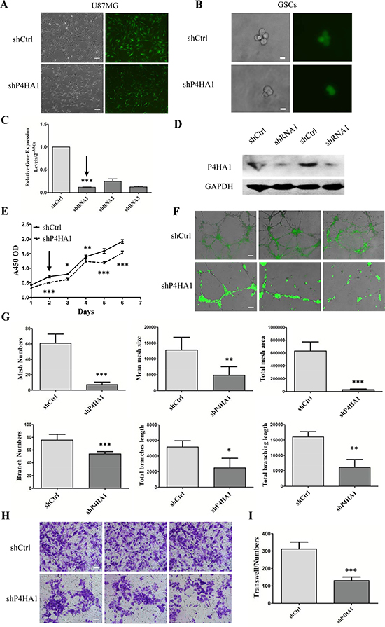 Knockdown of P4HA1 inhibits GSCs proliferation, tube formation and migration in vitro.