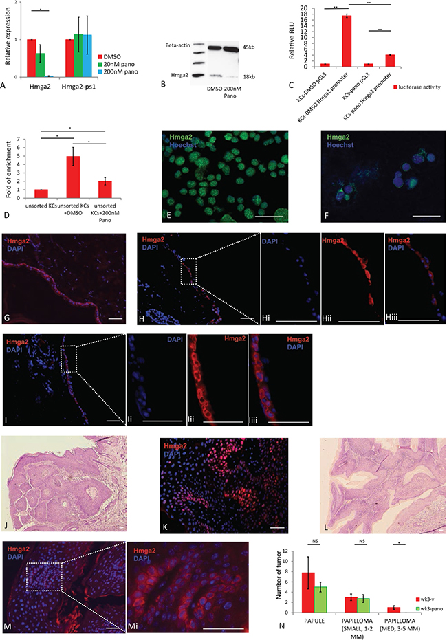 Hmga2 translocation to nucleus can be inhibited by panobinostat.