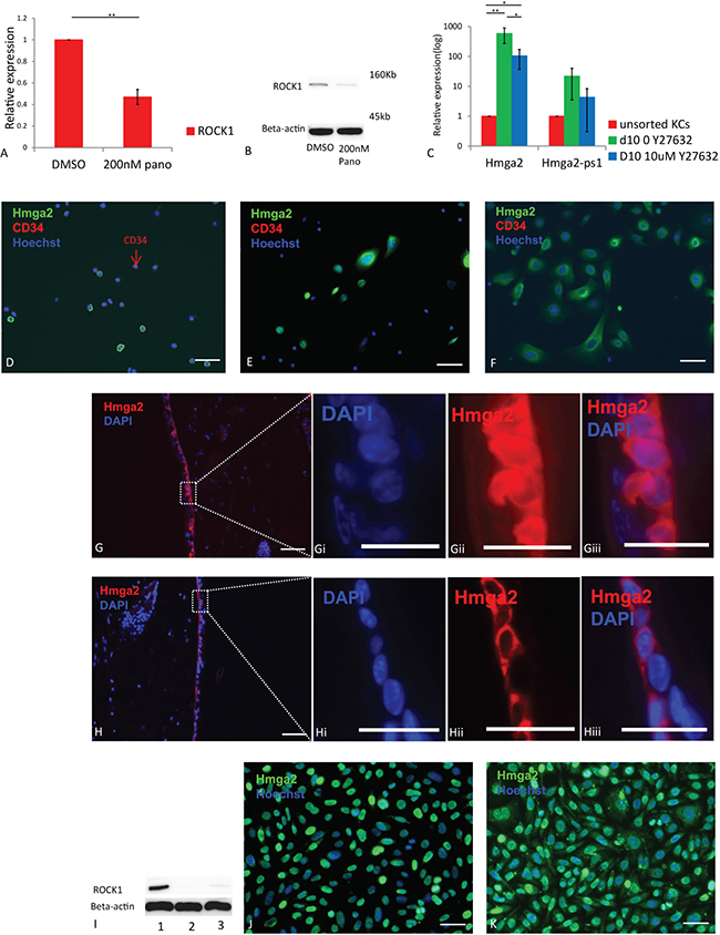 The inhibition of Hmga2 translocation is through ROCKs.