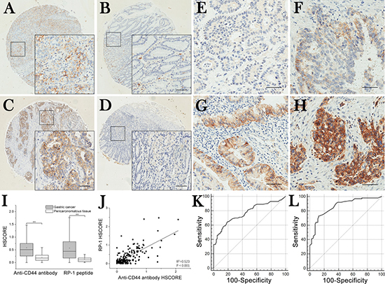 TMA immunohistochemistry staining and selection of cut-off scores.