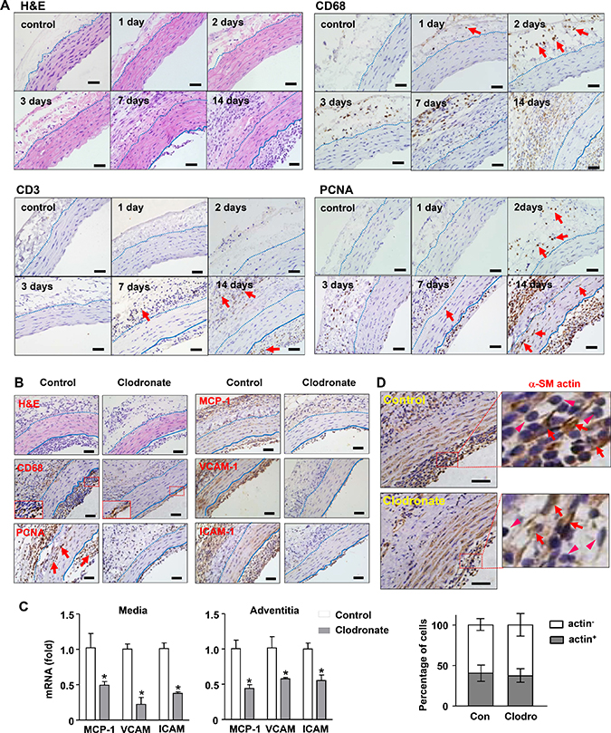 Effects of macrophage depletion with clodronate liposomes on transplantation-induced arterial remodeling and inflammation.