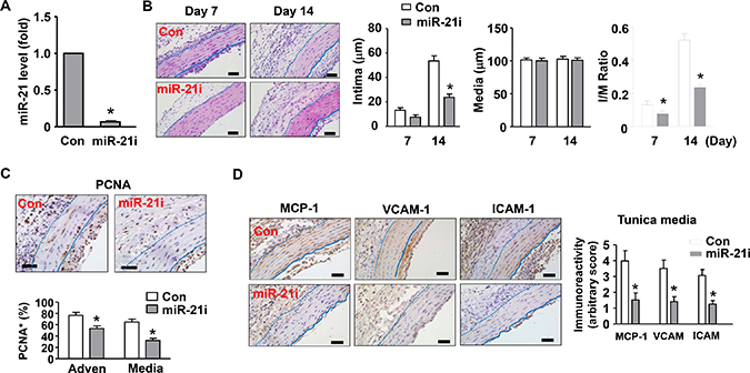 Effects of a miR-21 antagomir (miR-21i) on neointima formation in vivo.