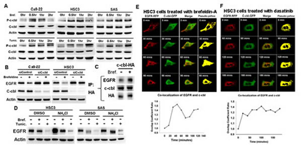 C-cbl-lysosome pathway mediated ER stress-induced EGFR degeradation.