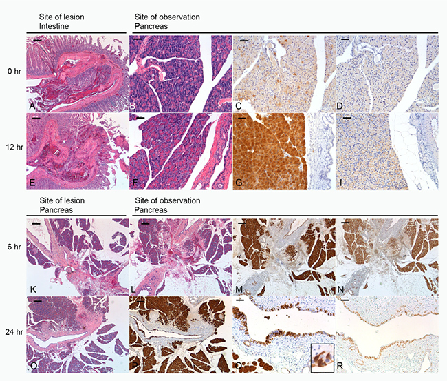 Morphology of lesions and their effect on the pancreas.