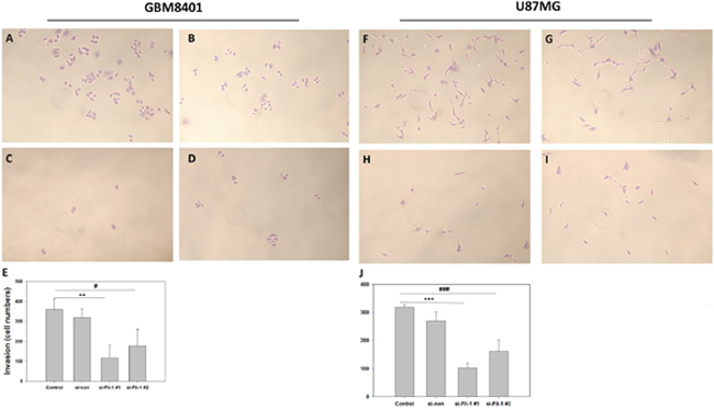 Single-day Transwell invasion analysis of GBM8401 cells and U87MG cells transfected with Fli-1 siRNA.