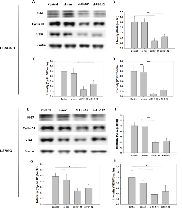 Expression levels of Ki-67, vascular endothelial growth factor (VEGF), and cyclin D1 proteins in control, non-siRNA-treated, and Fli-1 siRNA-treated cells in GBM8401 cells and U87MG cells.
