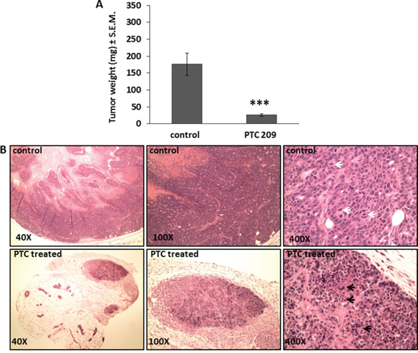 PTC 209 treatment results in decrease of tumor growth of FMMC 419II tumors.