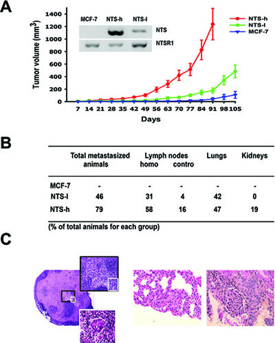 NTS/NTSR1 complex enhanced experimental tumor growth generated in human breast cancer cell lines.