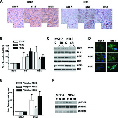 Figure 2 NTS autocrine and paracrine regulation enhanced EGFR, HER2, and HER3 basal expression and activation in human breast cancer cell lines.