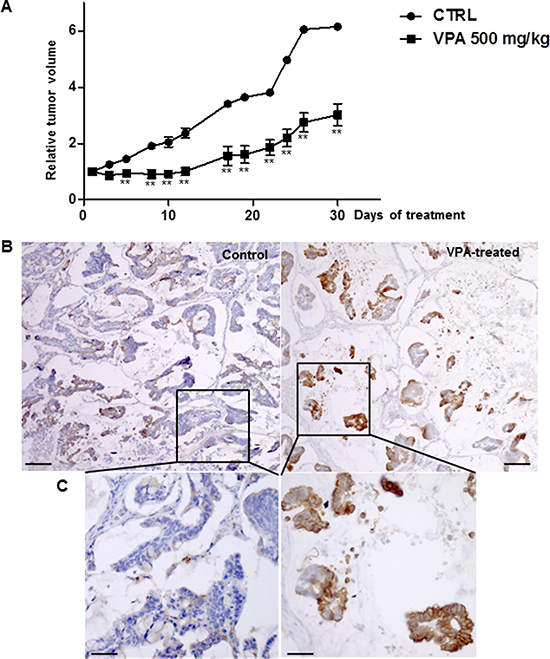 VPA treatment in a subcutaneous human colon tumor xenograft.