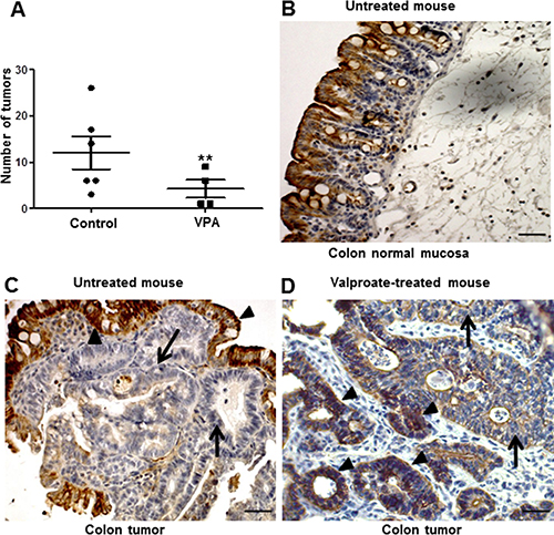 Intestinal CXCL12 expression and carcinoma development in control and VPA-treated APC&#x0394;14/+ mice.