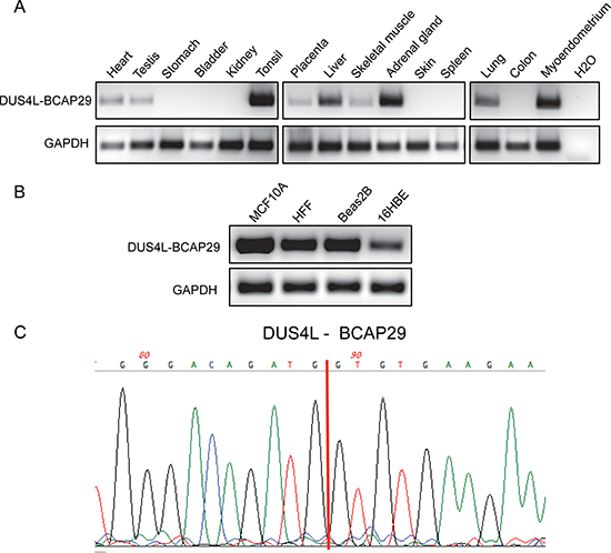 Detection of DUS4L-BCAP29 in non-cancer human tissues and cell lines.