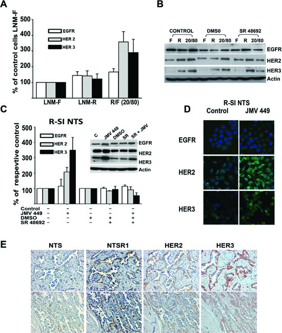 NTS regulation enhanced HER2, and HER3 basal expression in human lung cancer cell lines.
