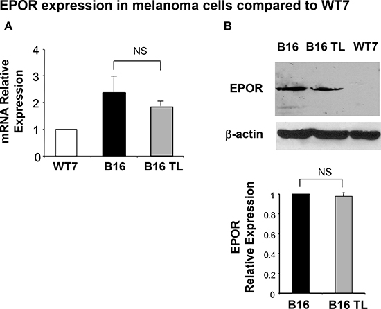 Expression of EPOR in B16 cells.