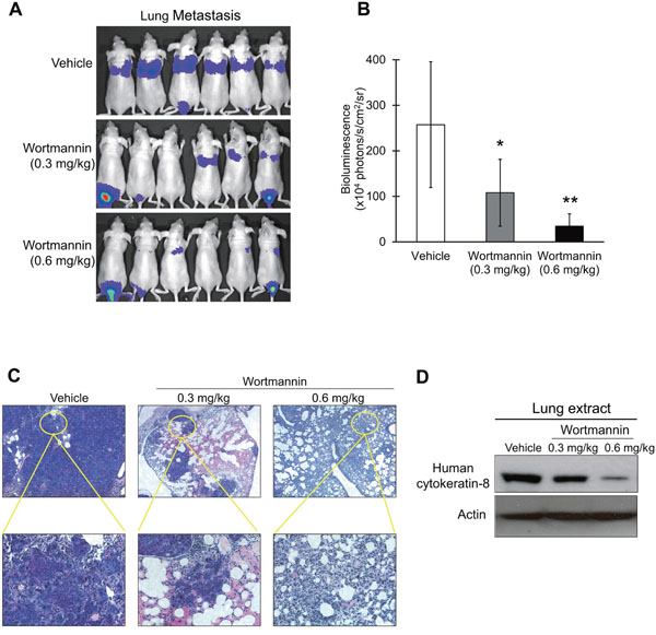 Effect of wortmannin treatment on metastasis of ESCC cells in nude mice.