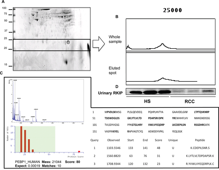 Purification and identification of RKIP.