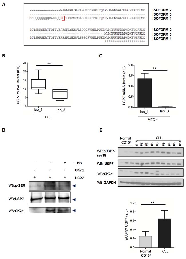 USP7 Post-translational modifications in CLL.