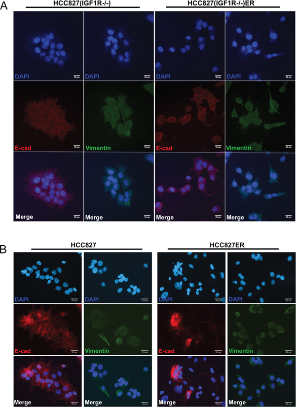 Acquirement and absence of EMT features in HCC827ER and HCC827(IGF1R&#x2212;/&#x2212;)ER cells, respectively.