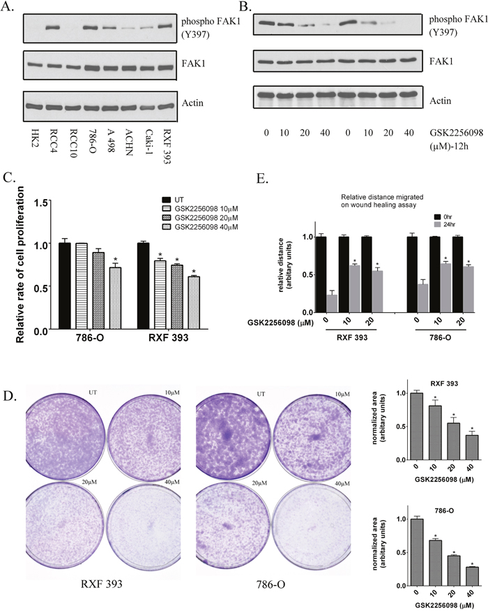 Inhibition of FAK kinase activity in RCC lines.